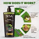 Where to get Sesa Black medicinal shampoo in Nairobi Kenya?
WhatsApp/Call 0716250250 / shop online www.kalonji.co.ke
Free Delivery 4 order over 3K